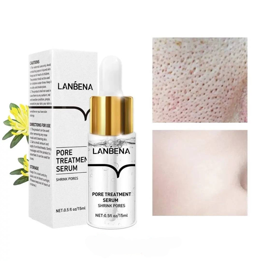 Lanbéna - Removedor de Cravos Hidratante Natural